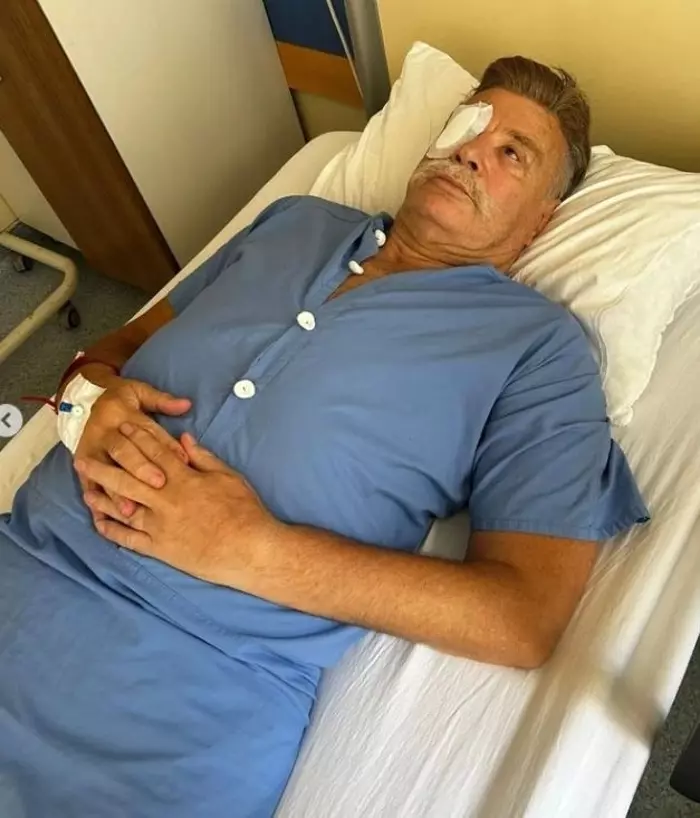 Nuri Alço, Kornea Nakli Oldu 22 nurialco