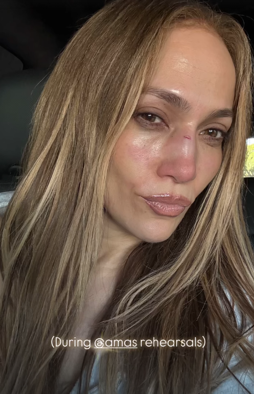 Jennifer Lopez AMA Provasında Yüzünden Yaralandı: 'Başıma Bu Geldi' 20 Ekran goruntusu 2025 05 14 124333