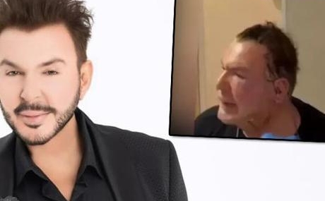 Kusum-Aydin-estetik-operasyon-gecirdi-Yeni-goruntuleri-paylasildi-featured