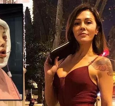 Yuz-nakli-operasyonuyla-Didem-Ceranin-sasirtici-donusumu-featured