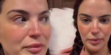 7.-kez-ameliyat-geciren-Asli-Bekiroglu-gozyaslariyla-durumu-paylasti-featured