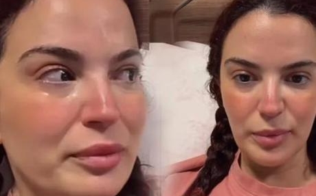 7.-kez-ameliyat-geciren-Asli-Bekiroglu-gozyaslariyla-durumu-paylasti-featured