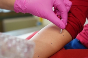 3,7 Kilo Tümörden Kurtulan 72 Yaşındaki Hasta Yeniden Yürüdü 1 thumbnail