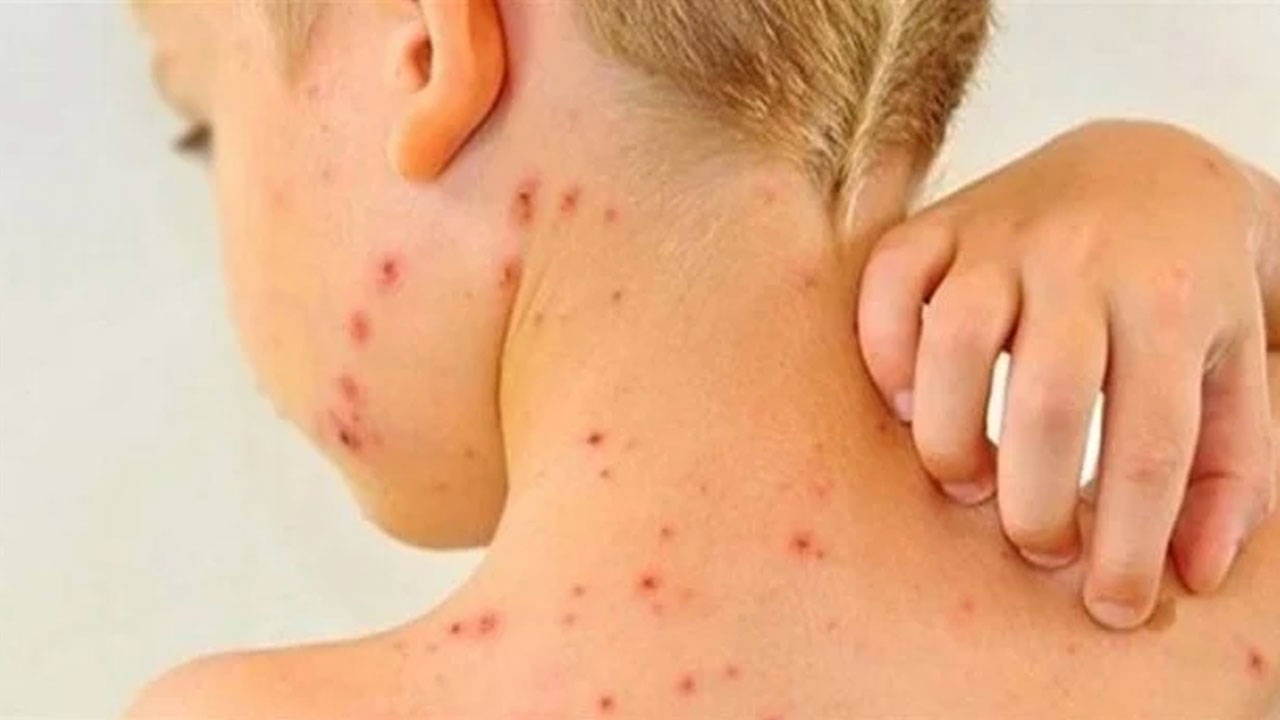 Banglades8217te-Kizamik-Felaketi-6-Haftada-113-Cocuk-Yasamini-Yitirdi-featured