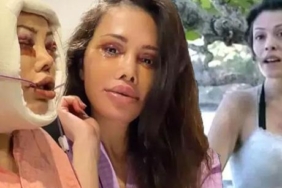 Didem-Ceran-yuz-nakli-sonrasi-son-halini-paylasti-‘Bebeksiligim-yapay-zeka-degil-featured