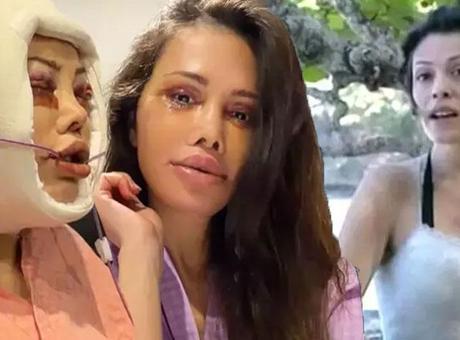 featured