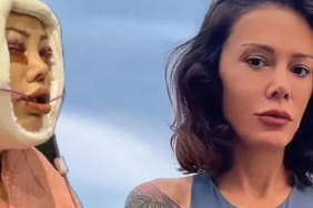 Didem-Ceran-yuz-nakli-sonrasi-yasadigi-sureci-paylasti-featured