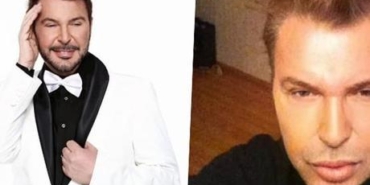 Kusum-Aydin-yuz-gerdirme-sonrasi-son-halini-takipcileriyle-paylasti-featured