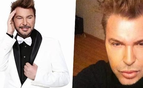 Kusum-Aydin-yuz-gerdirme-sonrasi-son-halini-takipcileriyle-paylasti-featured