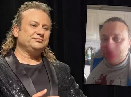 Onur-Akay-8216et-yiyen-bakteri8217-ile-savasiyor-Entube-edildi-featured