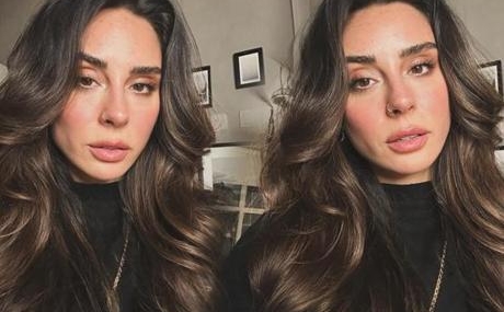 Talihsiz-kazada-bacagi-kirilan-Yasemin-Yuruk-son-durumunu-acikladi-featured