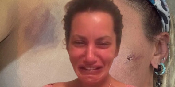 Yildiz-Asyali-ve-Esi-Mustafa-Semih-Demirci-Arasinda-Siddet-Krizi-featured