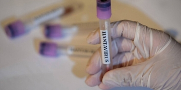 Hantavirus-Salgininda-Vaka-Sayisi-138217e-Cikti-DSO8217den-Aciklama-featured