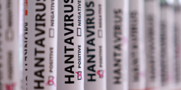 Hantavirus-Tehdidi-Hangi-Meslek-Gruplari-Daha-Fazla-Risk-Altinda-featured