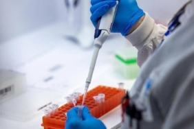 Ispanya-Hantavirus-Gorulen-Geminin-Limana-Yanasmasina-Izin-Verdi-featured