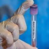 Ispanya8217da-Hantavirus-Alarmi-Bir-Kisi-Karantinaya-Alindi-featured
