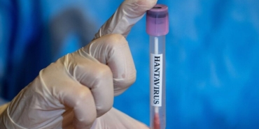 Ispanya8217da-Hantavirus-Alarmi-Bir-Kisi-Karantinaya-Alindi-featured