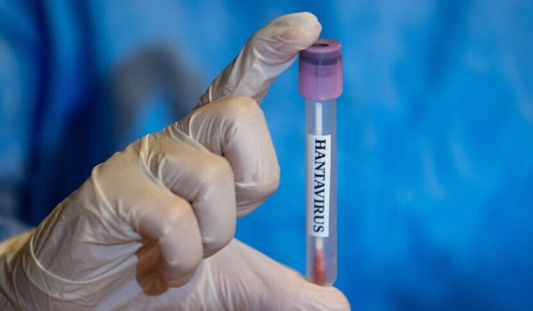 Prof.-Dr.-Geyik8217ten-Hantavirus-Uyarisi-Bobrekleri-Tehdit-Ediyor-featured