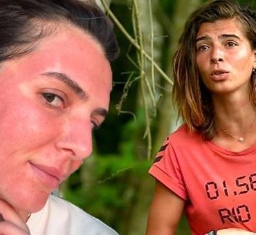 Survivor-Merve-Aydinin-estetik-degisimi-dikkat-cekti-featured