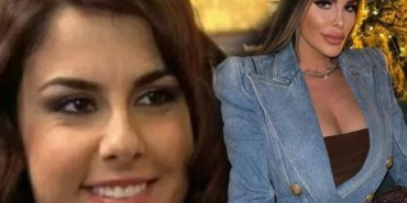 Tugce-Ozbudak8217in-Estetik-Degisimi-Goz-Kamastiriyor-featured