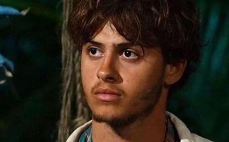 Bacagi-Ampute-Edilen-Survivor-Yarismacisi-Stavros-Floros8217un-Son-Durumu-featured