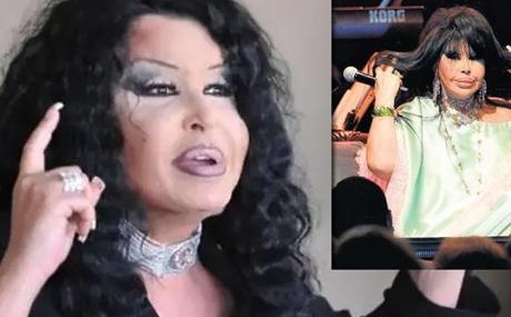 Bulent-Ersoy-Estetik-Sonrasi-Sahne-Performansiyla-Goz-Doldurdu-featured