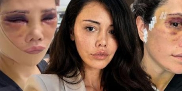 Didem-Ceran-Ameliyatinin-12.-Gununde-Paylasimlarina-Devam-Ediyor-featured