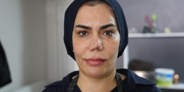 Burun-ameliyati-sonrasi-hayati-karardi-4-yilda-4-operasyon-featured