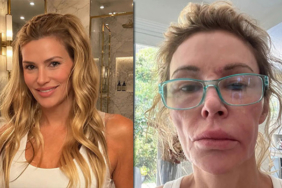 Brandi-Glanvillein-Hastalik-Cilesi-Yardim-Istemek-Zorunda-Kaldi-featured