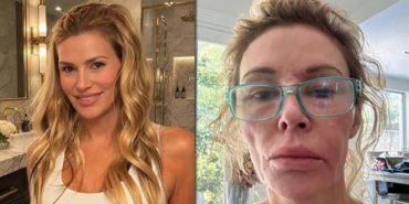 Brandi-Glanvillein-Hastalik-Cilesi-Yardim-Istemek-Zorunda-Kaldi-featured